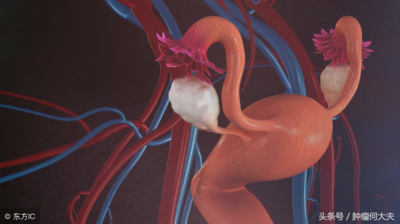 妇科有肿瘤会出现什么症状,妇科肿瘤一般是什么症状