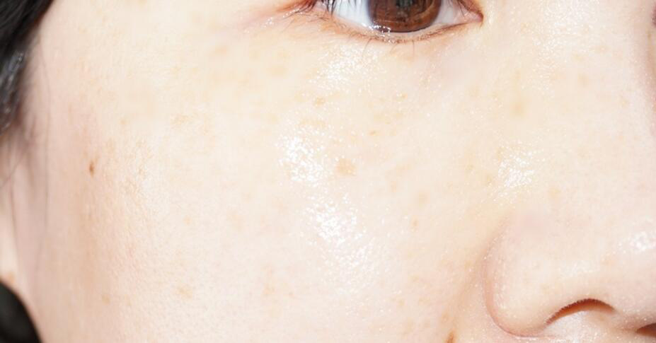 贝德玛卸妆水500ml和500g的区别 (bioderma贝德玛大瓶卸妆水怎么开)