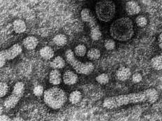 乙肝大三阳与乙肝小三阳怎么区分,大三阳小三阳是指哪几项