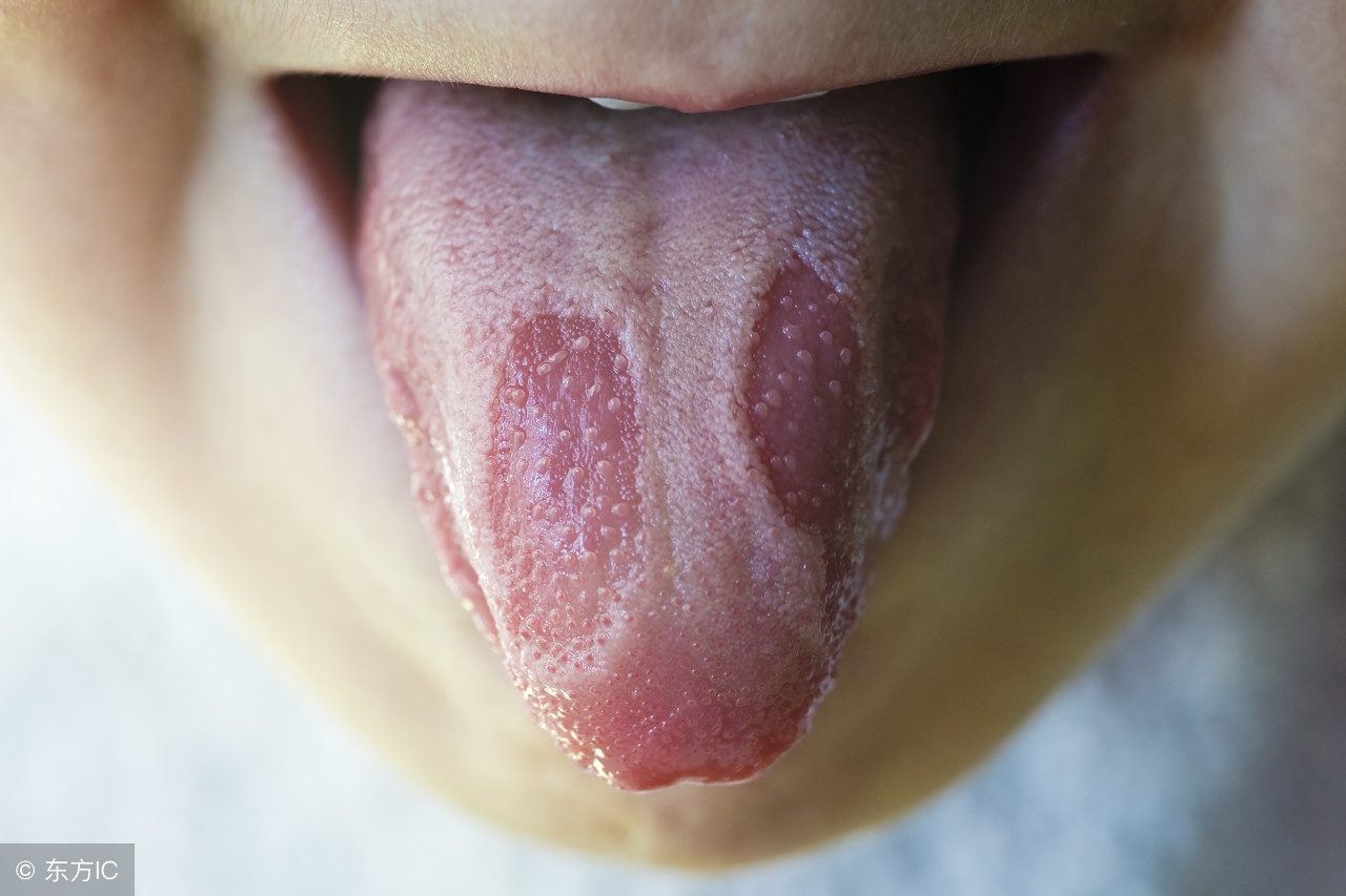 教你每天看看自己的舌苔,看舌苔的健康秘诀