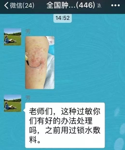 picc皮疹处理,picc湿疹的护理措施