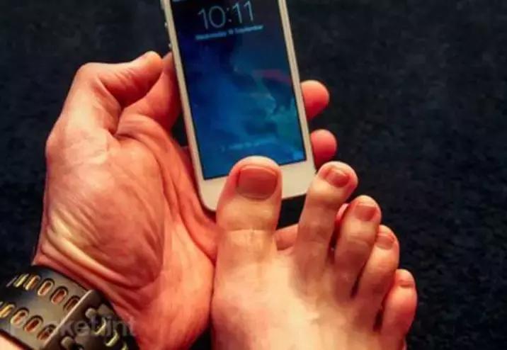 手没有了指纹,手没指纹了