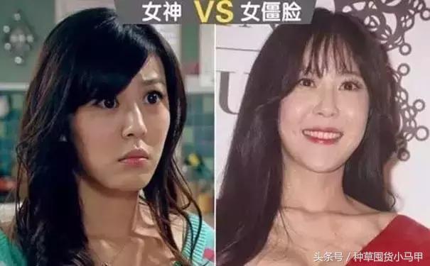 整形医生黑幕完整版,整形黑幕