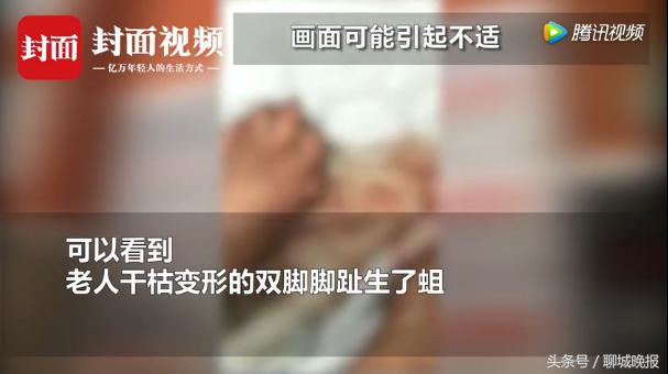 敬老院老人脚烂生蛆!院方:老人生病很正常,我们护理得相当好