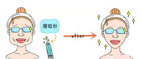 「嚓老空」瘦脸针？！你真的敢打吗？