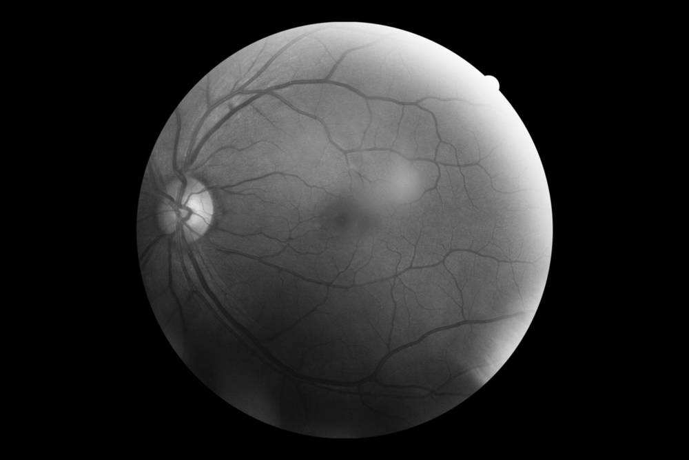 大脑中经常遇见的4个思维陷阱,大脑带给人的错觉