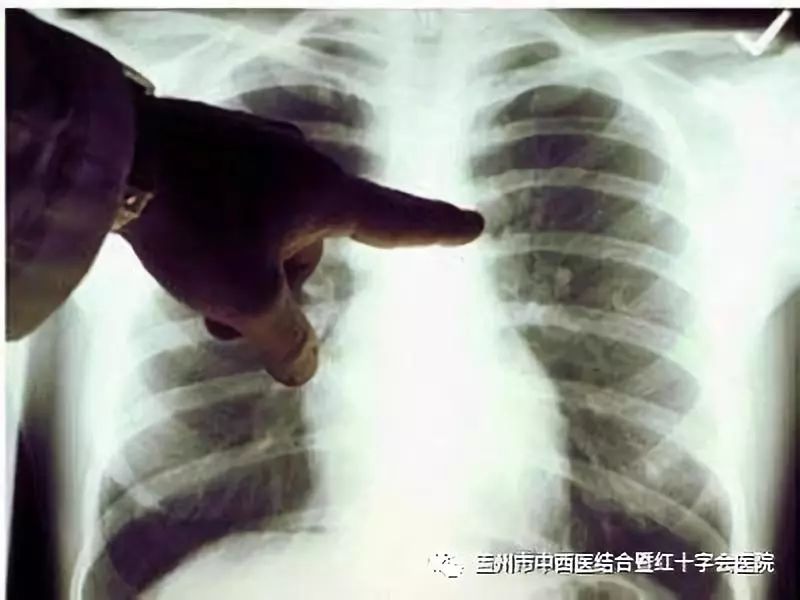 盖州人切记！对于疾病早发现、早治疗是成功治疗的关键！