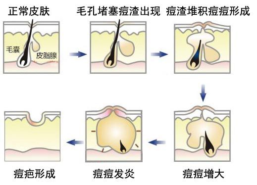 luna洁面仪日版和韩版哪个好,亲测好用四款洁面