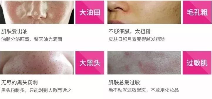 luna洁面仪日版和韩版哪个好,亲测好用四款洁面