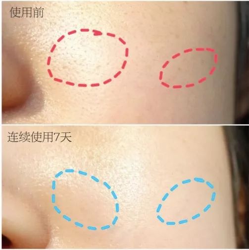 兰蔻赫莲娜海蓝之谜精华推荐,科颜氏修丽可兰蔻赫莲娜