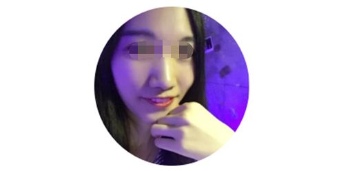 种植牙齿价格表多少钱一颗,种植牙齿最便宜多少钱一个月