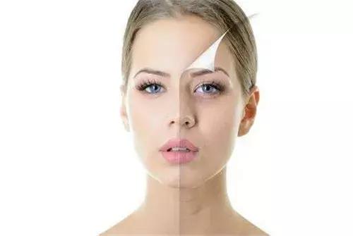 你以为补充维生素C就能白了？