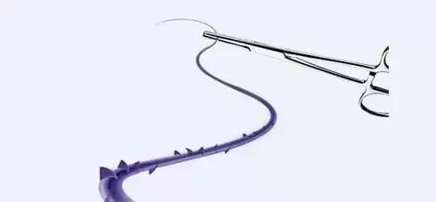 你知道线雕保容颜，却不知道是否适合你？