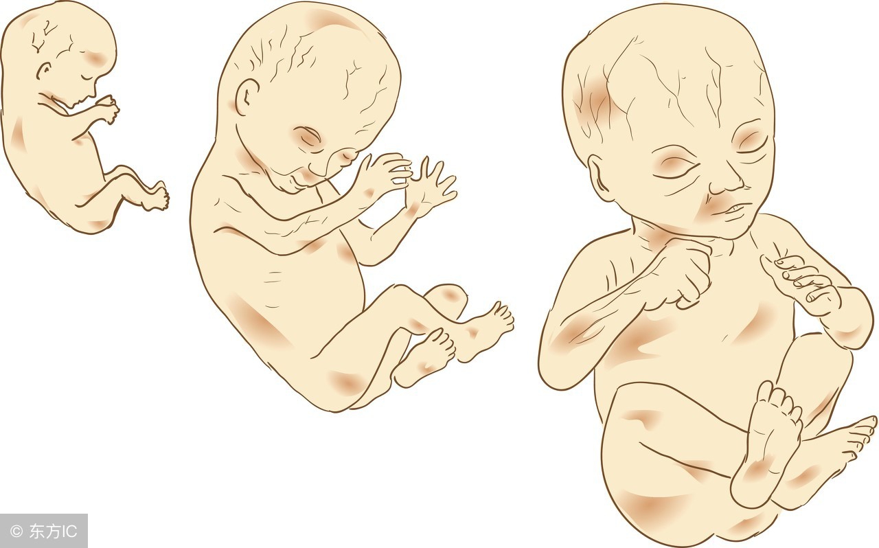 孕中期羊水过少怎么补救,孕期羊水过少怎么控制