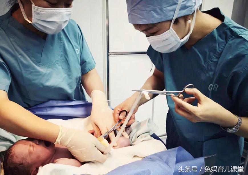 多数孕妈执意选择剖腹产,医生都会建议准妈妈选择剖腹产