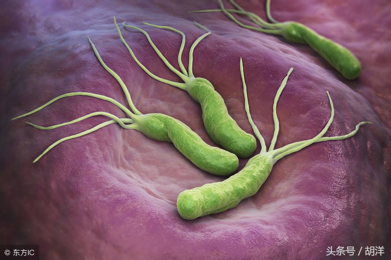 妇科真菌感染的克星,厌氧菌感染妇科怎么治疗