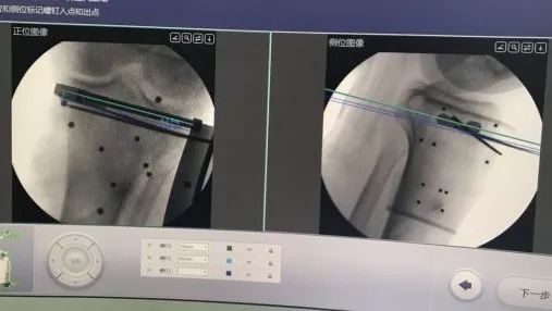 天玑加强版,新一代天玑