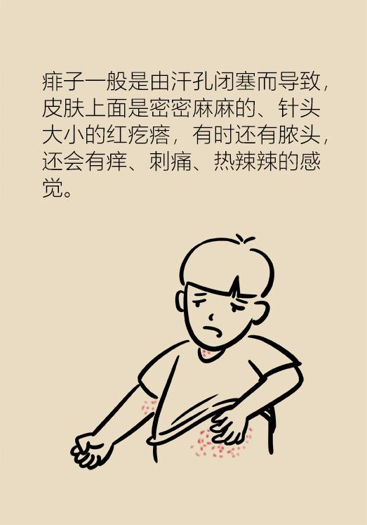 湿疹反复去医院挂哪个科,湿疹看西医反反复复怎么办