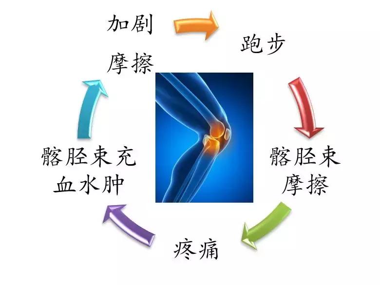 跑者”专利”:一文看懂膝外侧疼痛如何解决