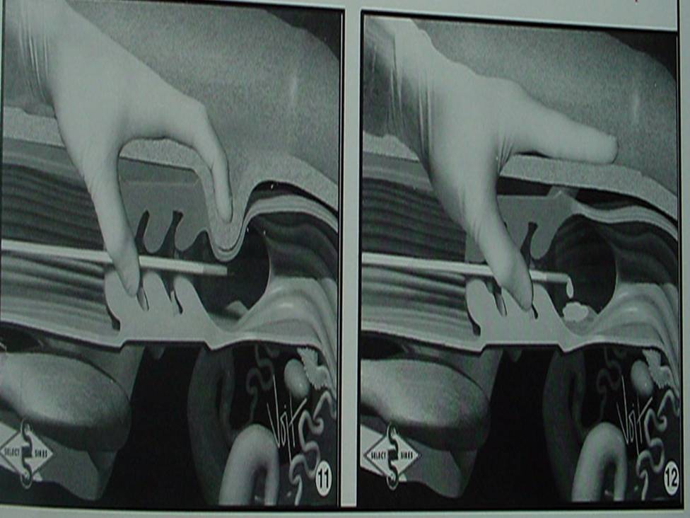 细管精液输精程序