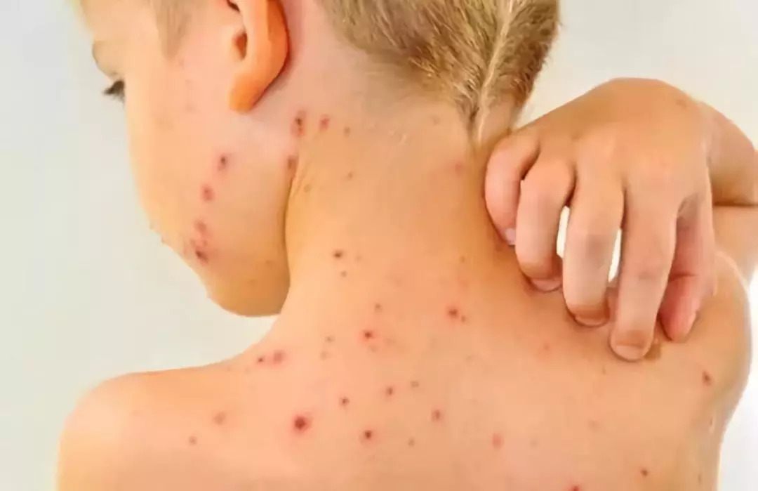 你永远不知道你家洗衣机有多脏,洗衣机长时间不清理会比马桶还脏