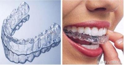 隐形牙套佩戴注意事项,替牙期隐形牙套佩戴管理
