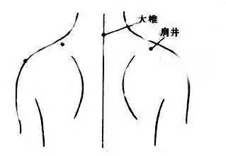 艾慈灸治疗咳嗽,怎么温灸治疗咳嗽