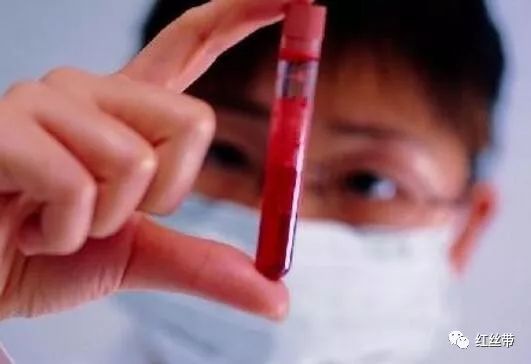 三个症状提醒你感染了艾滋病,怀疑自己可能感染艾滋病毒怎么办