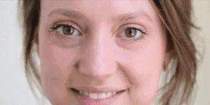 脾胃不和眼袋大怎样调理,补脾胃能不能治眼袋