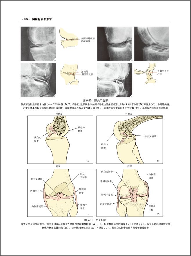 实用骨科影像学——原书第6版经典之作