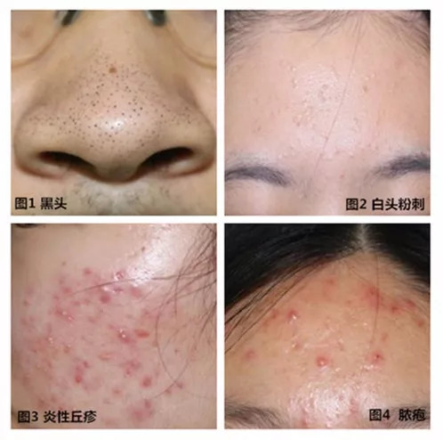 东部战区空军医院义诊,空军总医院元旦出诊安排