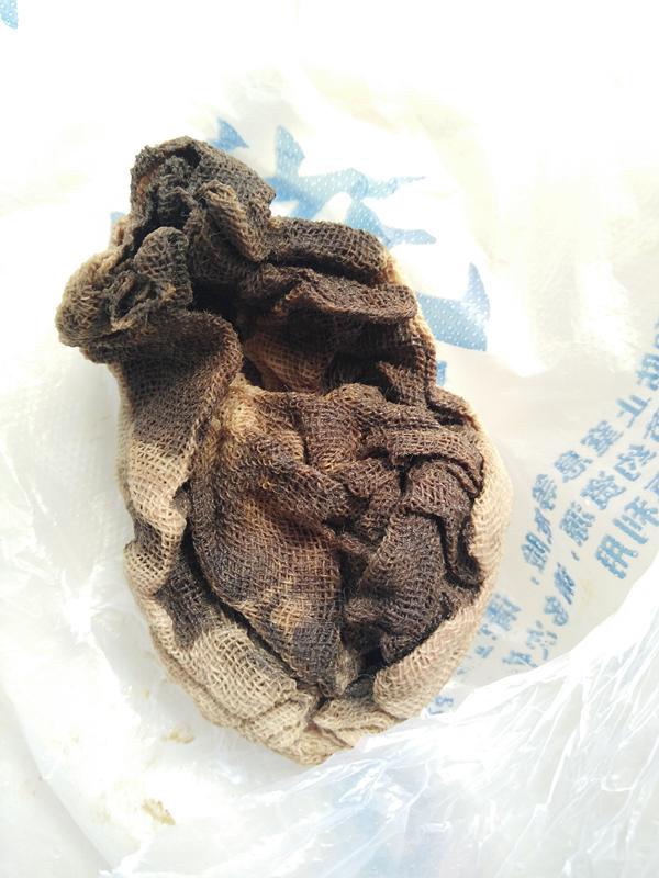 流产手术后有残留,流产手术全程疼痛难忍