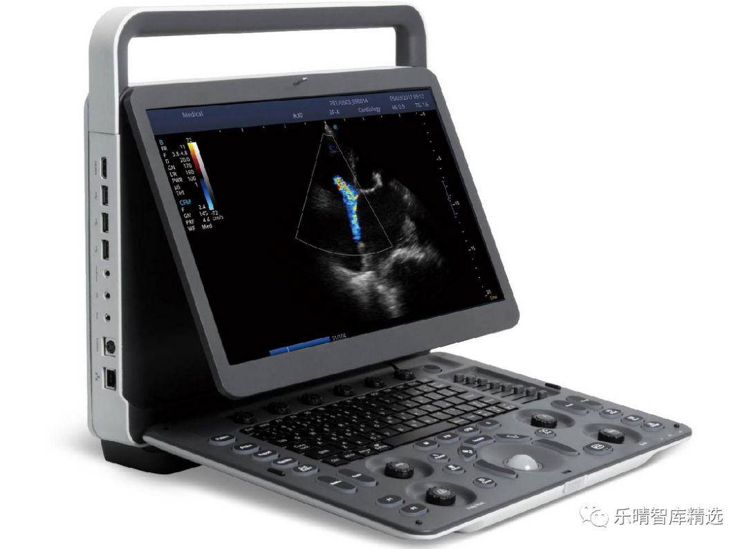 彩超发展到几代了,彩超技术发展史