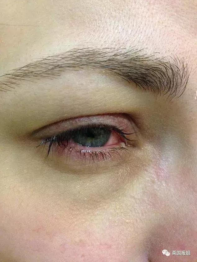 10鍏冨乏鍙崇殑moc,10鍏冪殑moc