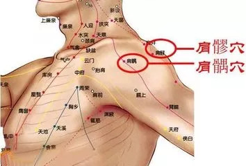 科普什么是肩周炎,粘连性肩关节囊炎的鉴别诊断