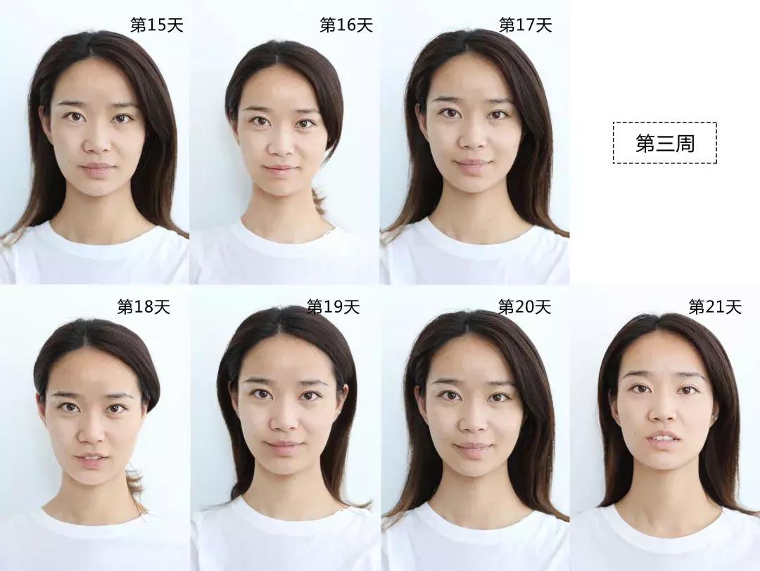 vc精华淡化法令纹暗沉,vc用了法令纹发黄