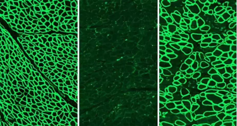 基因编辑改造人类治愈疾病,基因编辑有望治愈强直