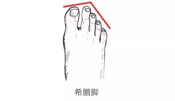 左脚埃及脚右脚罗马脚如何选鞋,你是埃及脚罗马脚还是希腊脚