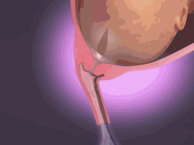 顺产10天肚子隐隐作痛怎么回事,你知道顺产要怎么用力吗