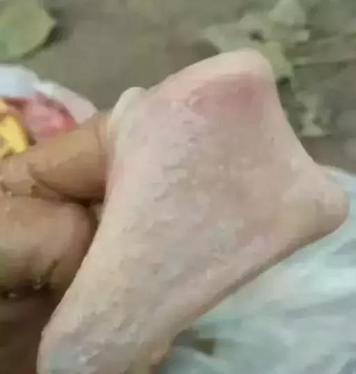 鸡吐水怎么治疗最有效,鸡吐水的最佳防治方案