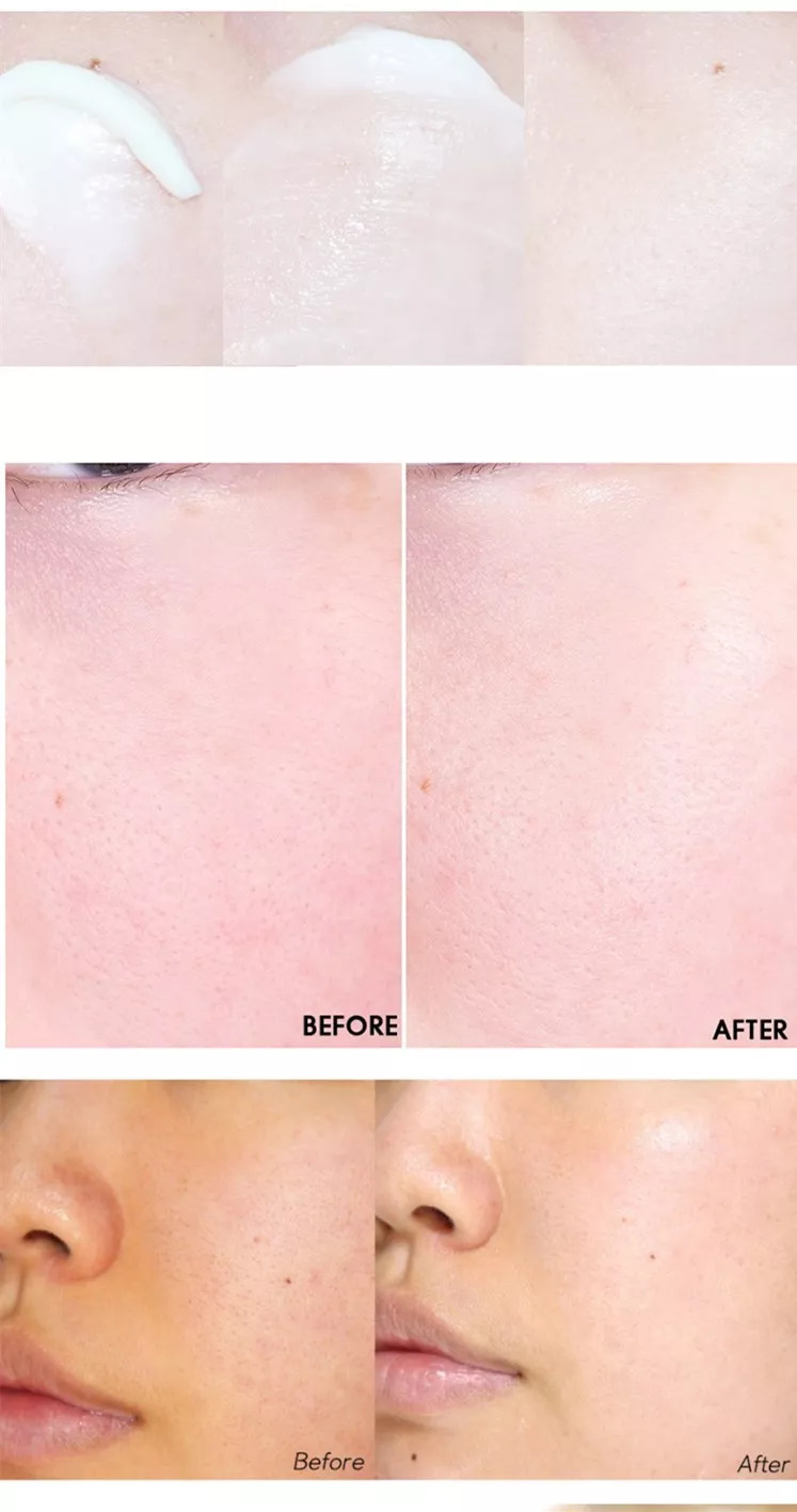 美白淡斑祛斑霜sk2,韩国东星祛斑霜好用吗