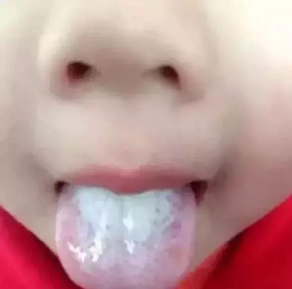 宝宝舌苔变化有什么症状,宝宝舌苔怎么样才是健康的