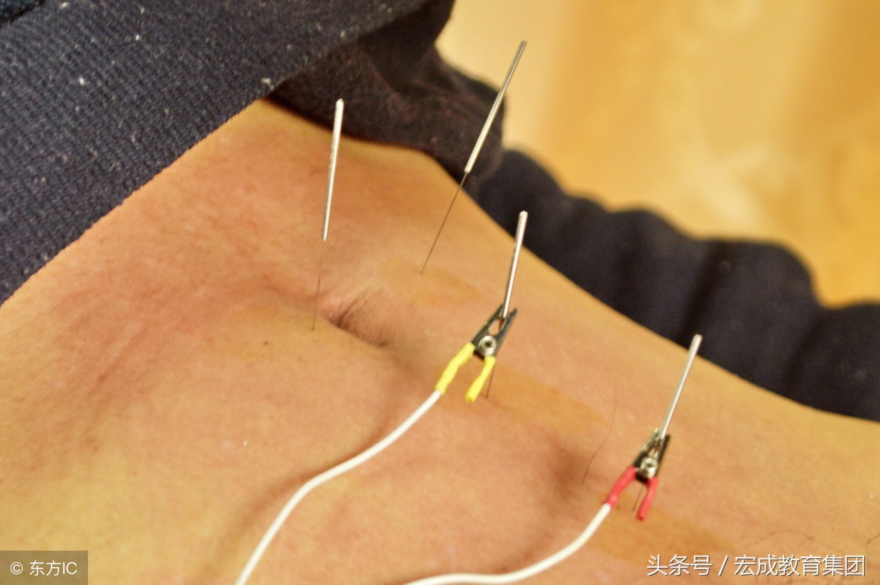 中医确有专长针灸考试视频,中医专长考核针灸技术类型