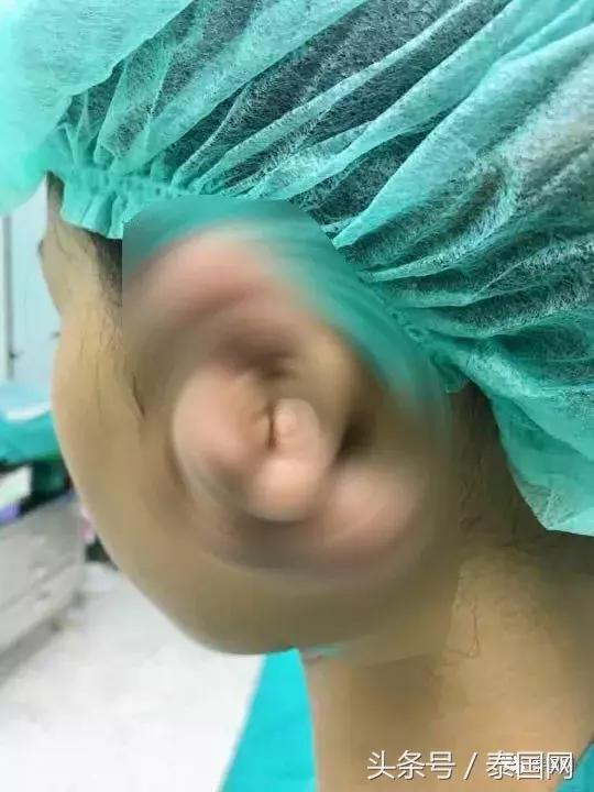 泰国女人打耳洞视频,泰国女子打耳洞