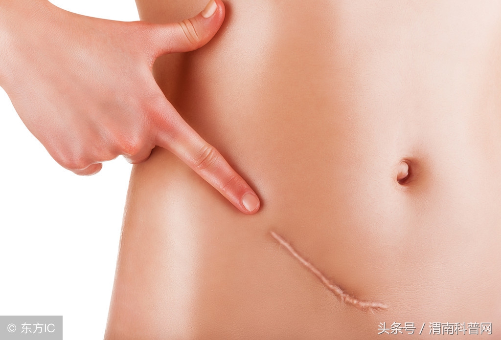 疤痕妊娠是否和疤痕位置有关,疤痕子宫疤痕妊娠算不算异常