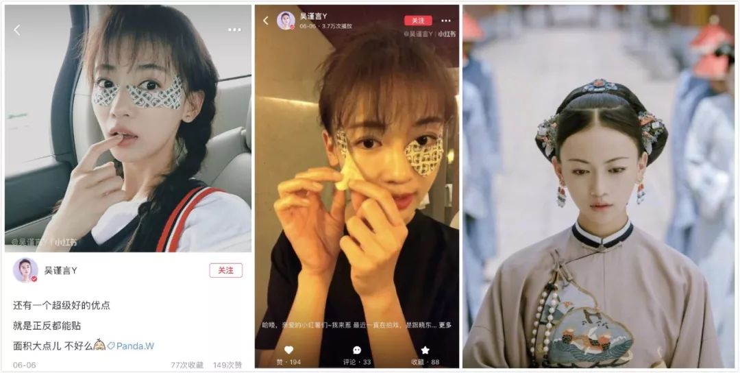 陆毅贝儿眼膜,陆毅用的眼膜