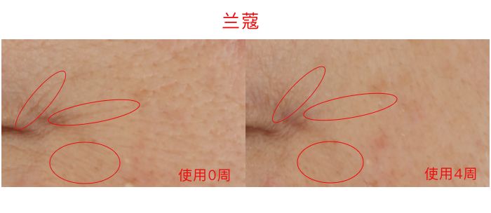 眼霜推荐lamer浓缩眼霜,lamer浓缩眼霜黑眼圈评测