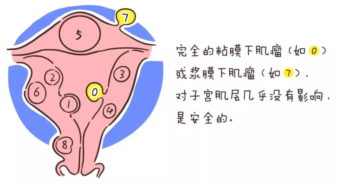 妇科疾病有哪些影响怀孕生孩子,女性妇科疾病不可怕