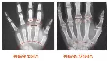 孩子正在身高潜能期，个子飙升技巧要牢记！