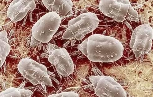 后背螨虫最佳去除方法,后背长螨虫解决方法